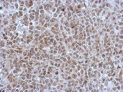 Immunohistochemistry-Paraffin: POM121 Antibody [NBP2-19890] - HBL435 xenograft, using POM121 antibody at 1:500 dilution. Antigen Retrieval: Trilogy™ (EDTA based, pH 8.0) buffer, 15min.