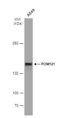 Western Blot: POM121 Antibody [NBP2-19890] - Whole cell extract (30 ug) was separated by 5% SDS-PAGE, and the membrane was blotted with POM121 antibody [N2N3] diluted at 1:2000. The HRP-conjugated anti-rabbit IgG antibody (NBP2-19301) was used to detect the primary antibody.