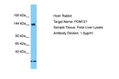 Western Blot: POM121 Antibody [NBP2-87975] - Host: Rabbit. Target Name: POM121. Sample Type: Fetal Liver lysates. Antibody Dilution: 1.0ug/ml