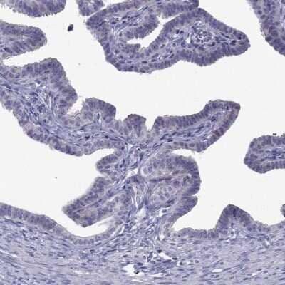 Immunohistochemistry-Paraffin: POM121L12 Antibody [NBP1-90526] - Staining of human fallopian tube shows low expression as expected.
