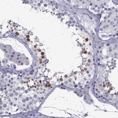 Immunohistochemistry-Paraffin: POM121L12 Antibody [NBP1-90526] - Staining of human testis shows high expression.