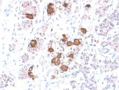 Immunohistochemistry-Paraffin: ACTH Antibody (CLIP/2040R) - Azide and BSA Free [NBP3-08621] - Formalin-fixed, paraffin-embedded human Pituitary stained with ACTH Rabbit Recombinant Monoclonal Antibody (CLIP/2040R).