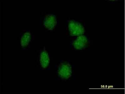 Immunocytochemistry/Immunofluorescence: POMC Antibody [H00005443-B02P] - Analysis of purified antibody to POMC on HeLa cell. (antibody concentration 10 ug/ml)