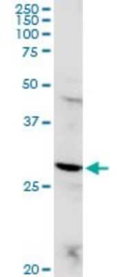 Western Blot: POMC Antibody [H00005443-D01P] - Analysis of POMC expression in IMR-32.