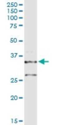 Western Blot: POMC Antibody [H00005443-D01P] - Analysis of POMC expression in mouse liver.
