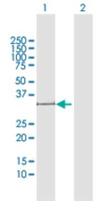 Western Blot: POMC Antibody [H00005443-D01P] - Analysis of POMC expression in transfected 293T cell line by POMC polyclonal antibody.Lane 1: POMC transfected lysate(29.40 KDa).Lane 2: Non-transfected lysate.