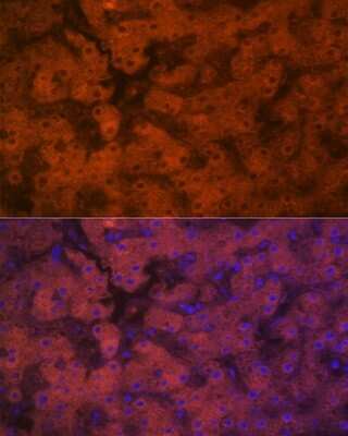 Immunohistochemistry: PON1 Antibody (4X7X2) [NBP3-16187] - Immunofluorescence analysis of human liver using PON1 Rabbit mAb (NBP3-16187) at dilution of 1:100 (40x lens). Blue: DAPI for nuclear staining.