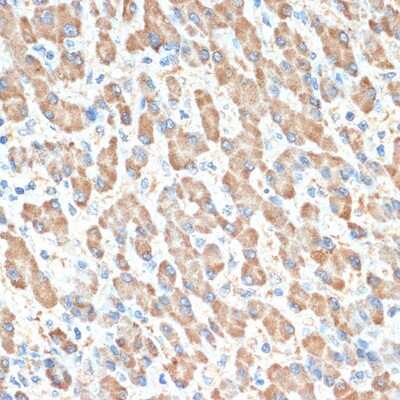 Immunohistochemistry-Paraffin: PON1 Antibody (4X7X2) [NBP3-16187] - Immunohistochemistry of paraffin-embedded human liver using PON1 Rabbit mAb (NBP3-16187) at dilution of 1:100 (40x lens).Perform microwave antigen retrieval with 10 mM Tris/EDTA buffer pH 9.0 before commencing with IHC staining protocol.