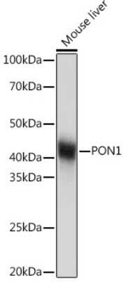 Western Blot: PON1 Antibody (4X7X2) [NBP3-16187] - Western blot analysis of extracts of Mouse liver, using PON1 Rabbit mAb (NBP3-16187) at 1:1000 dilution. Secondary antibody: HRP Goat Anti-Rabbit IgG (H+L) at 1:10000 dilution. Lysates/proteins: 25ug per lane. Blocking buffer: 3% nonfat dry milk in TBST. Detection: ECL Basic Kit. Exposure time: 1s.