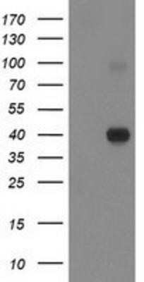 Western Blot: PON1 Antibody (OTI2D4) - Azide and BSA Free [NBP2-73526] - HEK293T cells were transfected with the pCMV6-ENTRY control (Left lane) or pCMV6-ENTRY PON1 (Right lane) cDNA for 48 hrs and lysed. Equivalent amounts of cell lysates (5 ug per lane) were separated by SDS-PAGE and immunoblotted with anti-PON1.