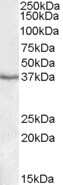 Western Blot: PON1 Antibody [NBP1-26401] - Analysis of PON1 in Human Liver lysate (35ug protein in RIPA buffer) using this antibody at 1 ug/ml. Primary incubation was 1 hour. Detected by chemiluminescence.