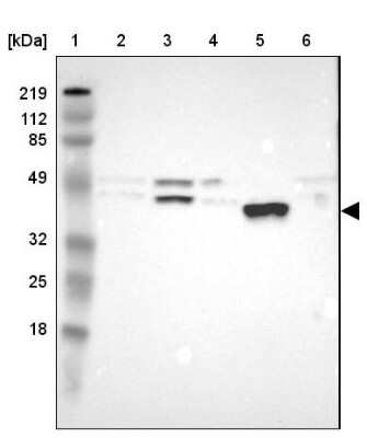 Western Blot: PON1 Antibody [NBP1-84791] - Lane 1: Marker  [kDa] 219, 112, 85, 49, 32, 25, 18.   Lane 2: Human cell line RT-4.  Lane 3: Human cell line U-251MG sp.  Lane 4: Human cell line A-431.  Lane 5: Human liver tissue.  Lane 6: Human tonsil tissue