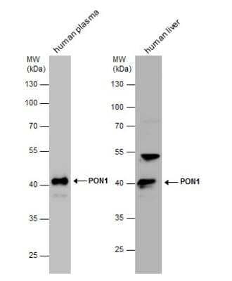 Western Blot: PON1 Antibody [NBP2-19893] - . Human tissue extracts (30 ug) was separated by 10% SDS-PAGE, and the membrane was blotted with PON1 antibody diluted at 1:1000.