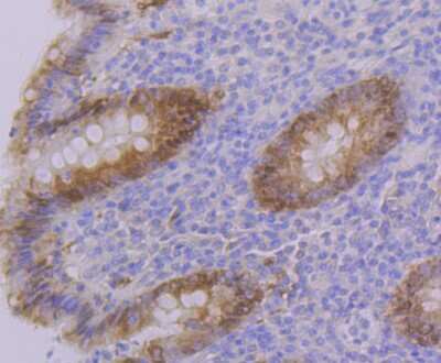 Immunohistochemistry-Paraffin: PON2 Antibody (JG35-80) [NBP2-75625] - Analysis of paraffin-embedded human appendix tissue using anti-PON2 antibody. Counter stained with hematoxylin.
