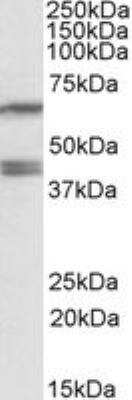 Western Blot: PON2 Antibody [NBP1-52005] - HepG2 lysate (35ug protein in RIPA buffer) using NBP1-52005 at 0.2ug/ml. Primary incubation was 1 hour. Detected by chemiluminescence.