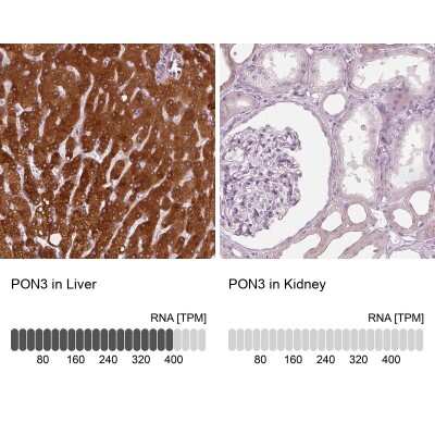 <b>Orthogonal Strategies Validation. </b>Immunohistochemistry-Paraffin: PON3 Antibody [NBP1-86074] - Staining in human liver and kidney tissues using anti-PON3 antibody. Corresponding PON3 RNA-seq data are presented for the same tissues.