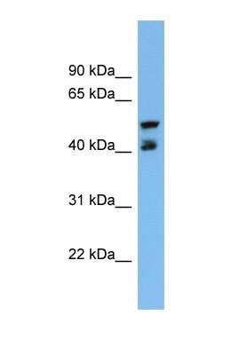 Western Blot: PON3 Antibody [NBP1-69633] - This Anti-PON3 antibody was used in Western Blot of NCI-H226     tissue lysate at a concentration of 1ug/ml.