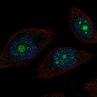 Immunocytochemistry/Immunofluorescence: POP1 Antibody [NBP2-68837] - Staining of human cell line PC-3 shows localization to nucleoli. Antibody staining is shown in green.