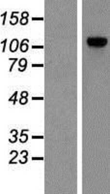 Western Blot: POP1 Overexpression Lysate (Adult Normal) [NBP2-07222] Left-Empty vector transfected control cell lysate (HEK293 cell lysate); Right -Over-expression Lysate for POP1.