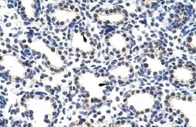Immunohistochemistry-Paraffin: POP4 Antibody [NBP1-57218] - Human Lung Alveolar cells (indicated with arrows), 4-8ug/ml.