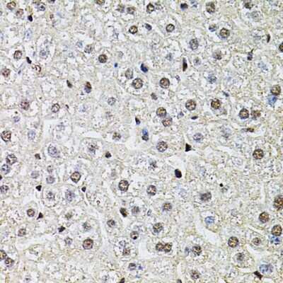 Immunohistochemistry-Paraffin POP4 Antibody - BSA Free