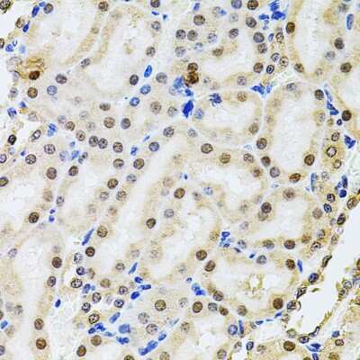 Immunohistochemistry-Paraffin: POP4 Antibody [NBP2-93109] - Rat kidney using POP4 antibody at dilution of 1:100 (40x lens).