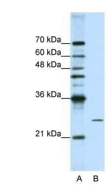 Western Blot: POP4 Antibody [NBP1-57218] - HepG2 cell lysate, Antibody Titration: 1.25ug/ml