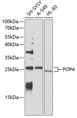 Western Blot POP4 Antibody - BSA Free