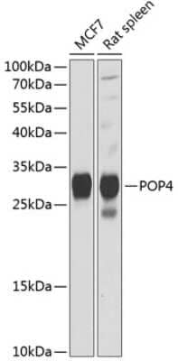 Western Blot: POP4 Antibody [NBP2-95131] - Analysis of extracts of various cell lines, using POP4 at 1:1000 dilution. Secondary antibody: HRP Goat Anti-Rabbit IgG (H+L) at 1:10000 dilution. Lysates/proteins: 25ug per lane. Blocking buffer: 3% nonfat dry milk in TBST. Detection: ECL Basic Kit . Exposure time: 90s.