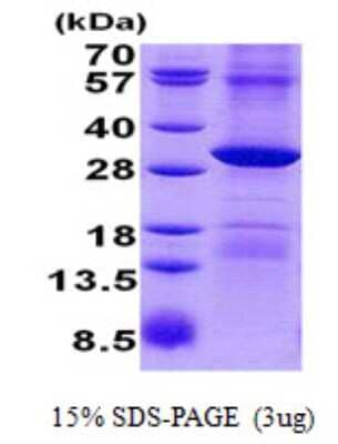 SDS-PAGE Recombinant Human POP4 His Protein