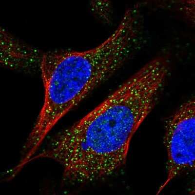 Immunocytochemistry/Immunofluorescence: POP7 Antibody [NBP1-92282] - Staining of human cell line U-2 OS shows localization to vesicles. Antibody staining is shown in green.