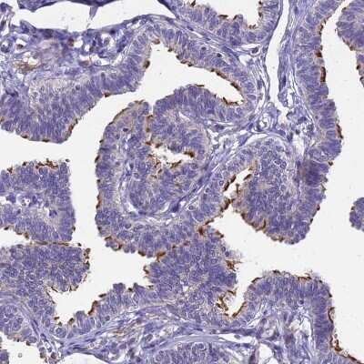 Immunohistochemistry-Paraffin POP7 Antibody