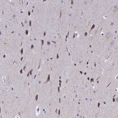 Immunohistochemistry-Paraffin: POP7 Antibody [NBP1-92282] - Staining of human cerebral cortex shows moderate cytoplasmic positivity in neurons.