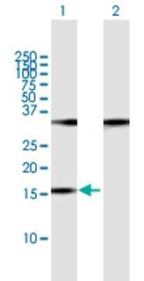 Western Blot: POP7 Antibody [H00010248-B01P] - Analysis of POP7 expression in transfected 293T cell line by POP7 polyclonal antibody.  Lane 1: POP7 transfected lysate(15.4 KDa). Lane 2: Non-transfected lysate.