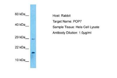 Western Blot: POP7 Antibody [NBP2-88073] - Host: Rabbit. Target Name: POP7. Sample Type: Hela Whole Cell lysates. Antibody Dilution: 1.0ug/ml