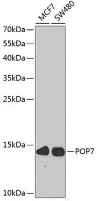 Western Blot: POP7 Antibody [NBP2-93910] - Analysis of extracts of various cell lines, using POP7 at 1:1000 dilution. Secondary antibody: HRP Goat Anti-Rabbit IgG (H+L) at 1:10000 dilution. Lysates/proteins: 25ug per lane. Blocking buffer: 3% nonfat dry milk in TBST. Detection: ECL Basic Kit . Exposure time: 90s.