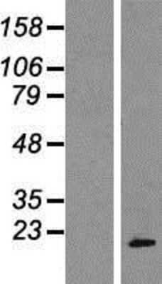 Western Blot: POP7 Overexpression Lysate (Adult Normal) [NBP2-07694] Left-Empty vector transfected control cell lysate (HEK293 cell lysate); Right -Over-expression Lysate for POP7.