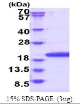 SDS-Page: POP7 Recombinant Protein [NBP2-51761] - 15% SDS Page (3 ug)