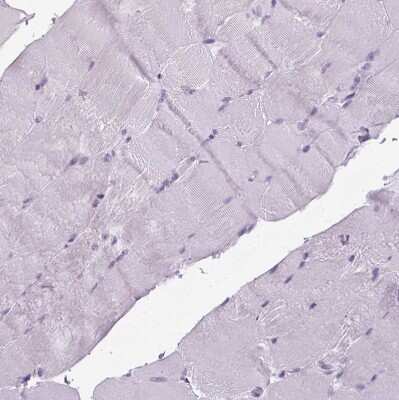 Immunohistochemistry-Paraffin: POPDC2 Antibody [NBP1-87256] - Staining of human skeletal muscle shows no positivity in myocytes as expected.