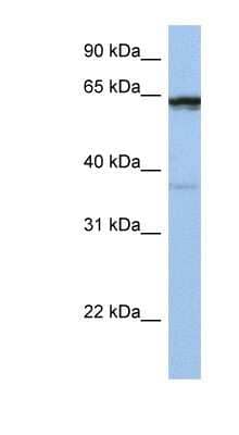 Western Blot: POPDC2 Antibody [NBP1-60108] - Titration: 0.2-1 ug/ml Positive Control: Jurkat cell lysate.