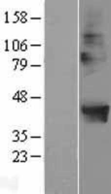 Western Blot: POPDC2 Overexpression Lysate (Adult Normal) [NBL1-14609] Left-Empty vector transfected control cell lysate (HEK293 cell lysate); Right -Over-expression Lysate for POPDC2.