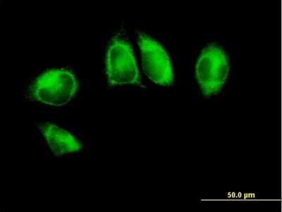 Immunocytochemistry/Immunofluorescence: POR/Cytochrome P450 Reductase Antibody [H00005447-B01P] - Analysis of purified antibody to POR on HeLa cell. (antibody concentration 10 ug/ml)