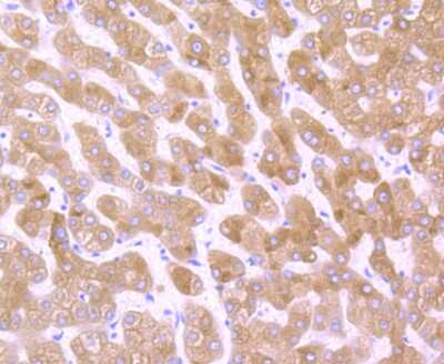 Immunohistochemistry-Paraffin: POR/Cytochrome P450 Reductase Antibody (JB54-31) [NBP2-75626] - Analysis of paraffin-embedded human liver tissue using anti-Cytochrome P450 Reductase antibody. Counter stained with hematoxylin.