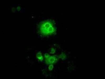 Immunocytochemistry/Immunofluorescence: POR/Cytochrome P450 Reductase Antibody (OTI3F10) - Azide and BSA Free [NBP2-73539] - Staining of COS7 cells transiently transfected by pCMV6-ENTRY Cytochrome P450 Reductase.