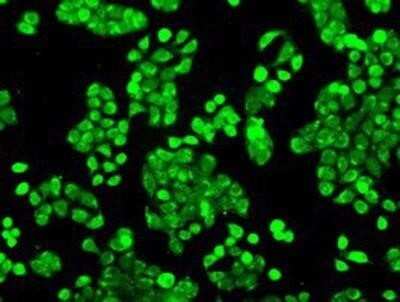 Immunocytochemistry/Immunofluorescence: POR/Cytochrome P450 Reductase Antibody (OTI3F10) - Azide and BSA Free [NBP2-73539] - Staining of HT29 cells using anti-Cytochrome P450 Reductase mouse monoclonal antibody.