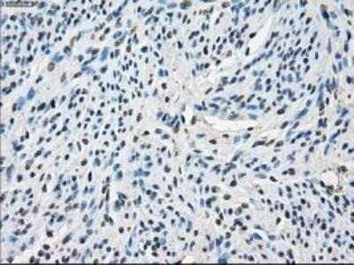 Immunohistochemistry: POR/Cytochrome P450 Reductase Antibody (OTI3F10) - Azide and BSA Free [NBP2-73539] - Staining of paraffin-embedded Human endometrium tissue using anti-Cytochrome P450 Reductase mouse monoclonal antibody.