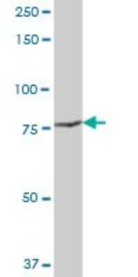 Western Blot: POR/Cytochrome P450 Reductase Antibody [H00005447-B01P] - Analysis of POR expression in human liver.