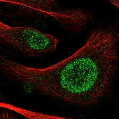 Immunocytochemistry/Immunofluorescence: POT1 Antibody [NBP2-57891] - Staining of human cell line U-2 OS shows localization to nucleoplasm. Antibody staining is shown in green.