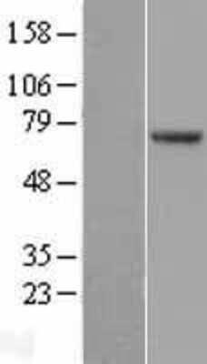 Western Blot: POT1 Overexpression Lysate (Adult Normal) [NBL1-14614] Left-Empty vector transfected control cell lysate (HEK293 cell lysate); Right -Over-expression Lysate for POT1.