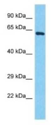 Western Blot: POTEB Antibody [NBP3-09877] - Western blot analysis of POTEB in HepG2 Whole Cell lysates. Antibody dilution at 1.0ug/ml